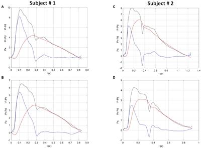 Carotid Reservoir Pressure Decrease After Prolonged Head Down Tilt Bed Rest in Young Healthy Subjects Is Associated With Reduction in Left Ventricular Ejection Time and Diastolic Length